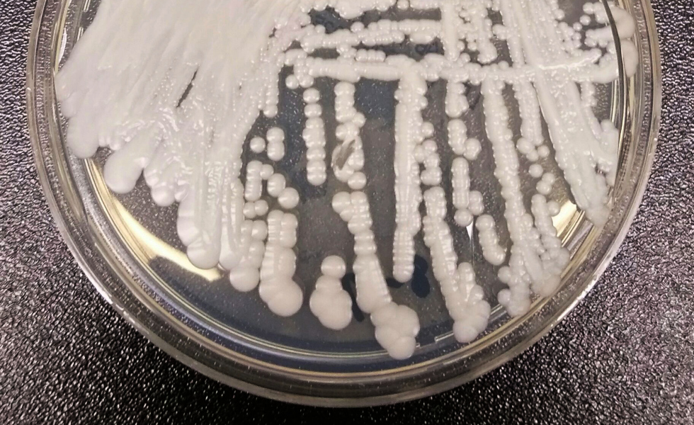 Alerta sanitaria por la rápida propagación del hongo Candida auris en hospitales europeos