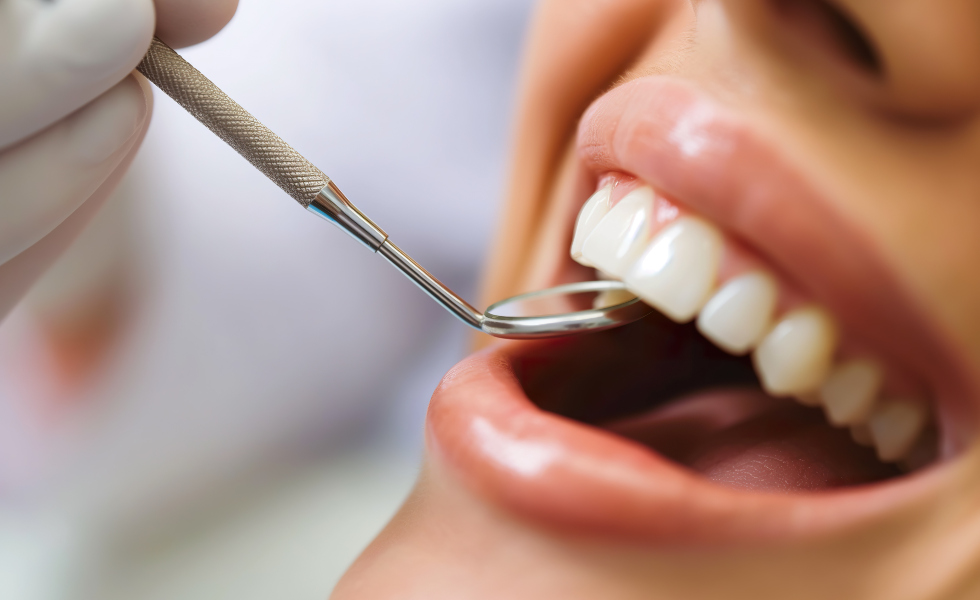 Restauraciones con composite: estética y funcionalidad en la odontología moderna