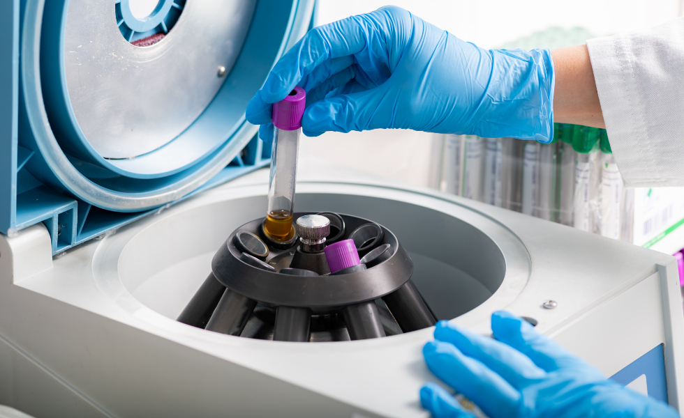 Duras cr&iacute;ticas por dejar expirar el contrato con la empresa encargada del an&aacute;lisis de las pruebas  |Image licensed by &copy; Ingram Image