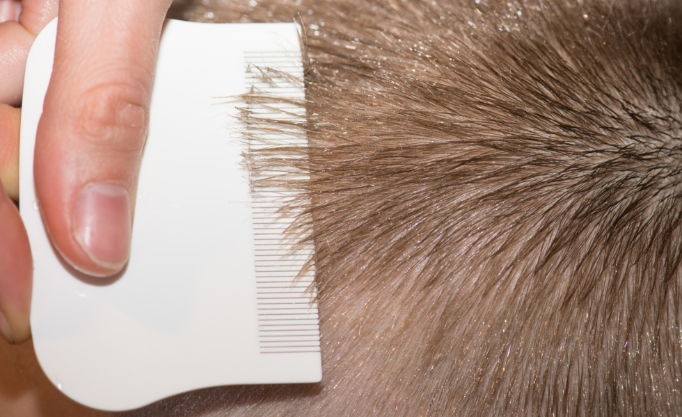 Eliminar los piojos: 67 euros por cabeza en centros especializados