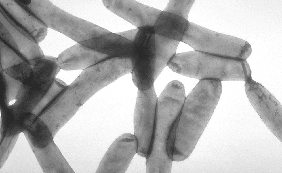 La legionelosis registra un aumento de 155 casos en España respecto a 2023