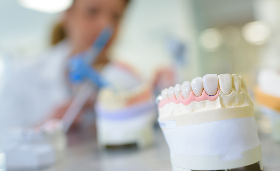 Coronas dentales: cómo recuperar la funcionalidad y la armonía de tu sonrisa